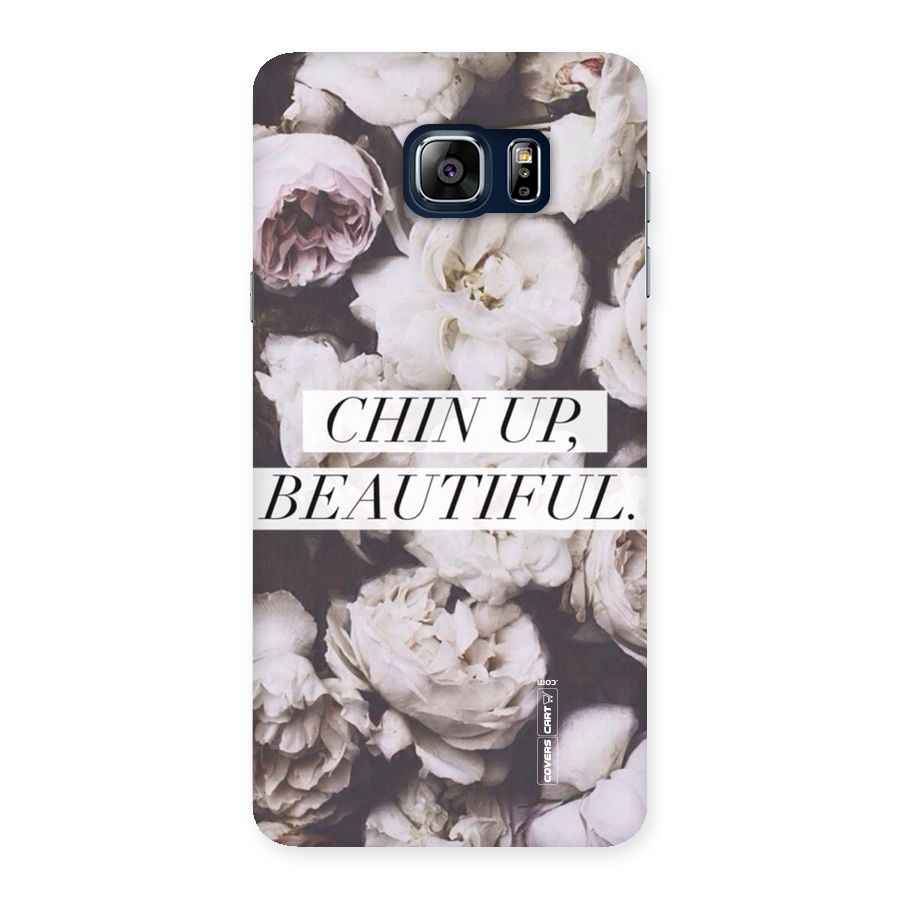 Chin Up Beautiful Back Case for Galaxy Note 5