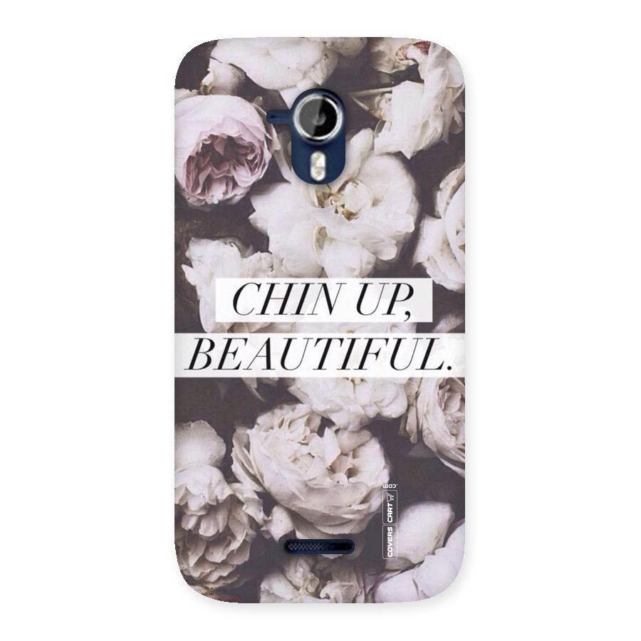 Chin Up Beautiful Back Case for Micromax Canvas Magnus A117
