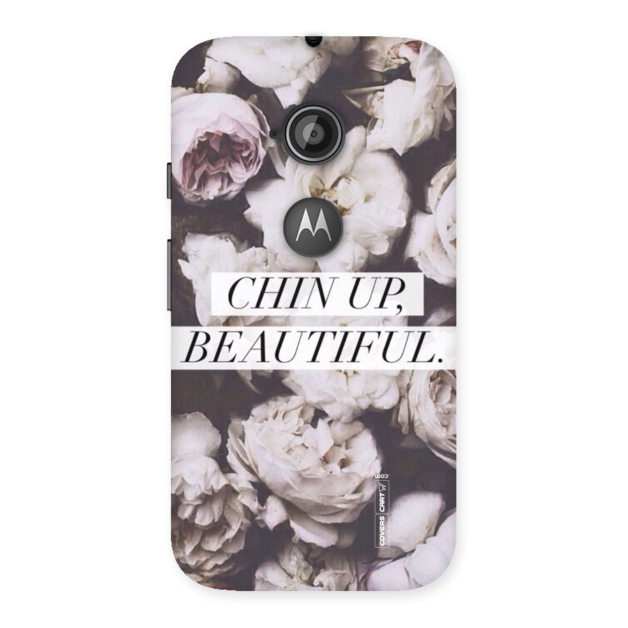 Chin Up Beautiful Back Case for Moto E 2nd Gen