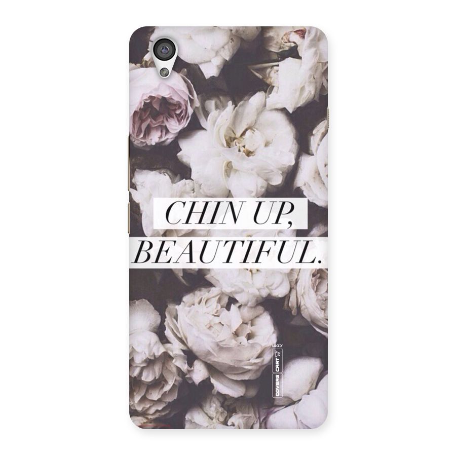 Chin Up Beautiful Back Case for OnePlus X