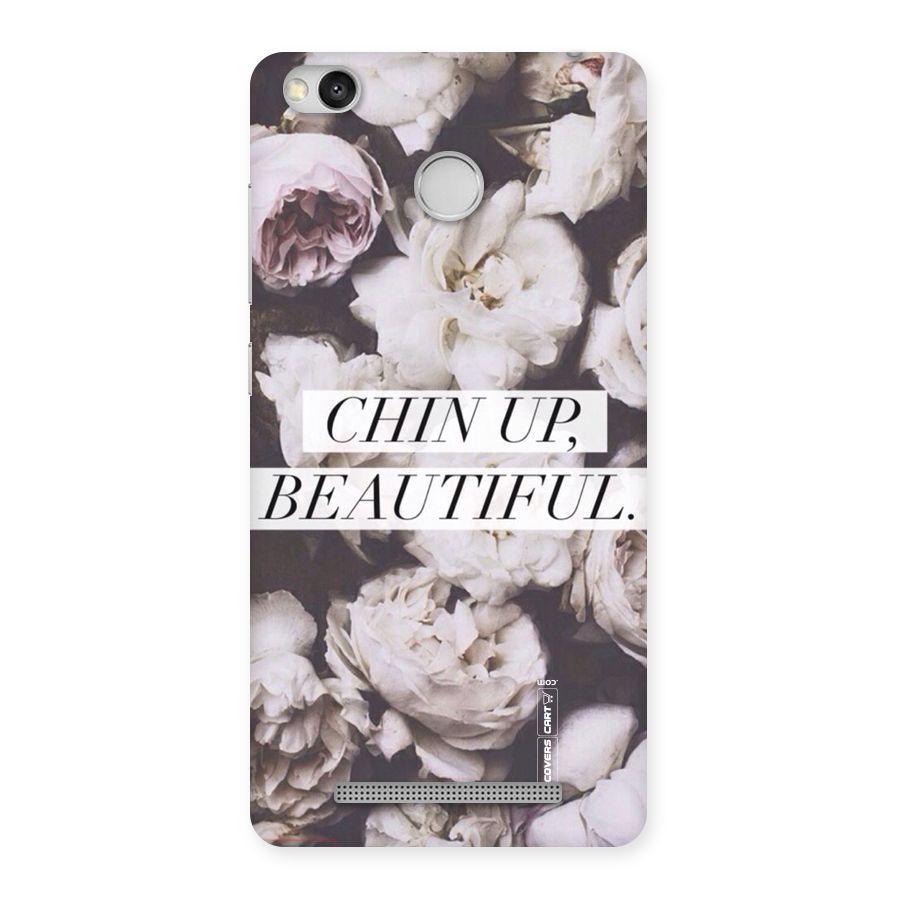 Chin Up Beautiful Back Case for Redmi 3S Prime