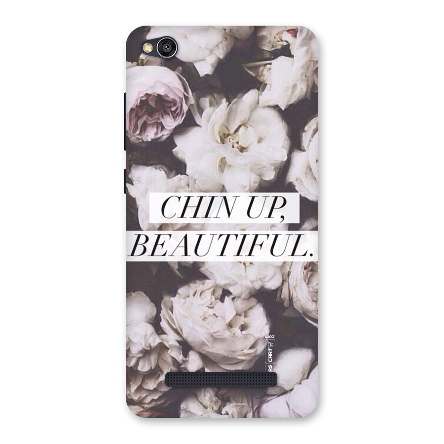 Chin Up Beautiful Back Case for Redmi 4A