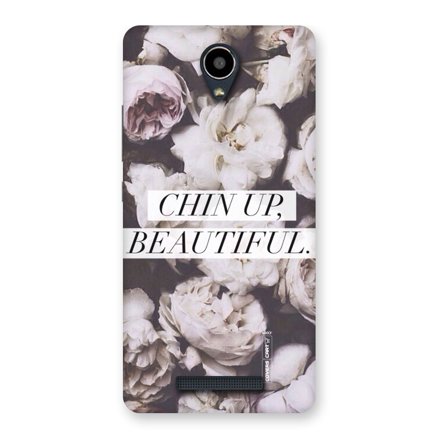Chin Up Beautiful Back Case for Redmi Note 2
