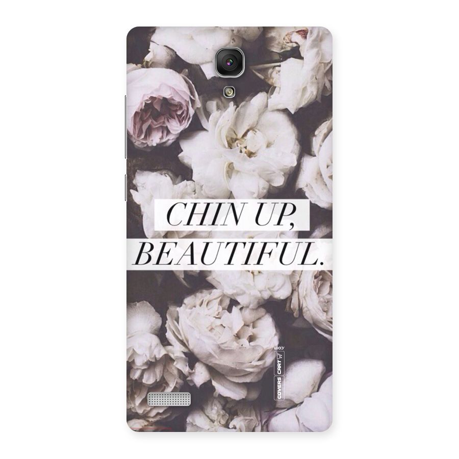Chin Up Beautiful Back Case for Redmi Note Prime