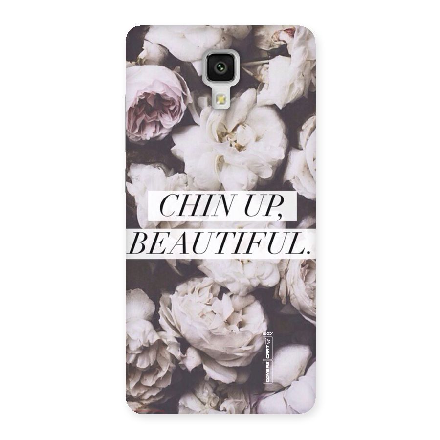 Chin Up Beautiful Back Case for Xiaomi Mi 4