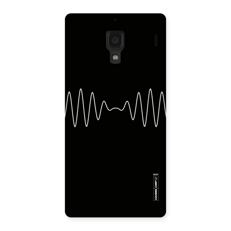 White Minimal Thread Back Case for Redmi 1S