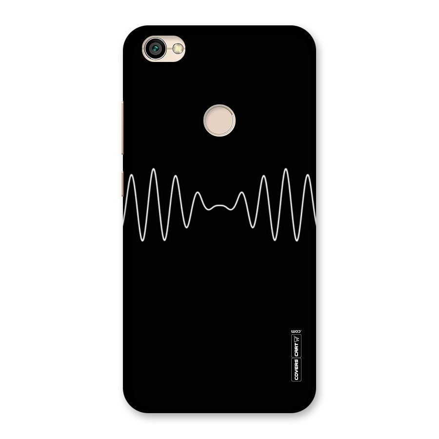 White Minimal Thread Back Case for Redmi Y1 2017