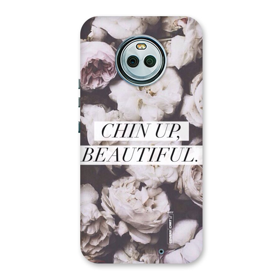 Chin Up Beautiful Back Case for Moto X4