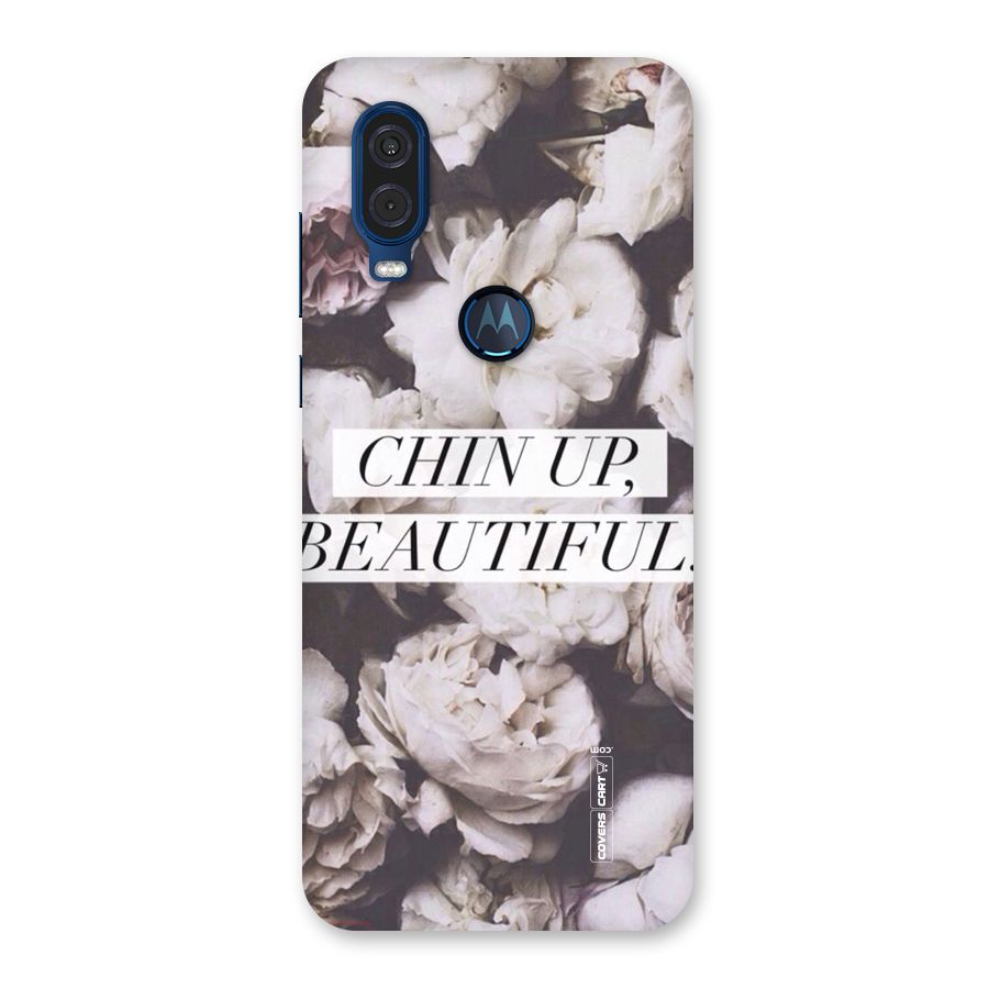 Chin Up Beautiful Back Case for Motorola One Vision