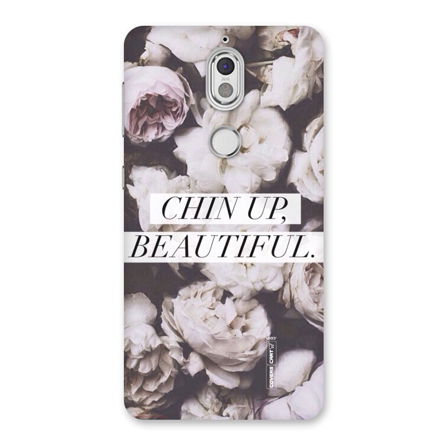 Chin Up Beautiful Back Case for Nokia 7
