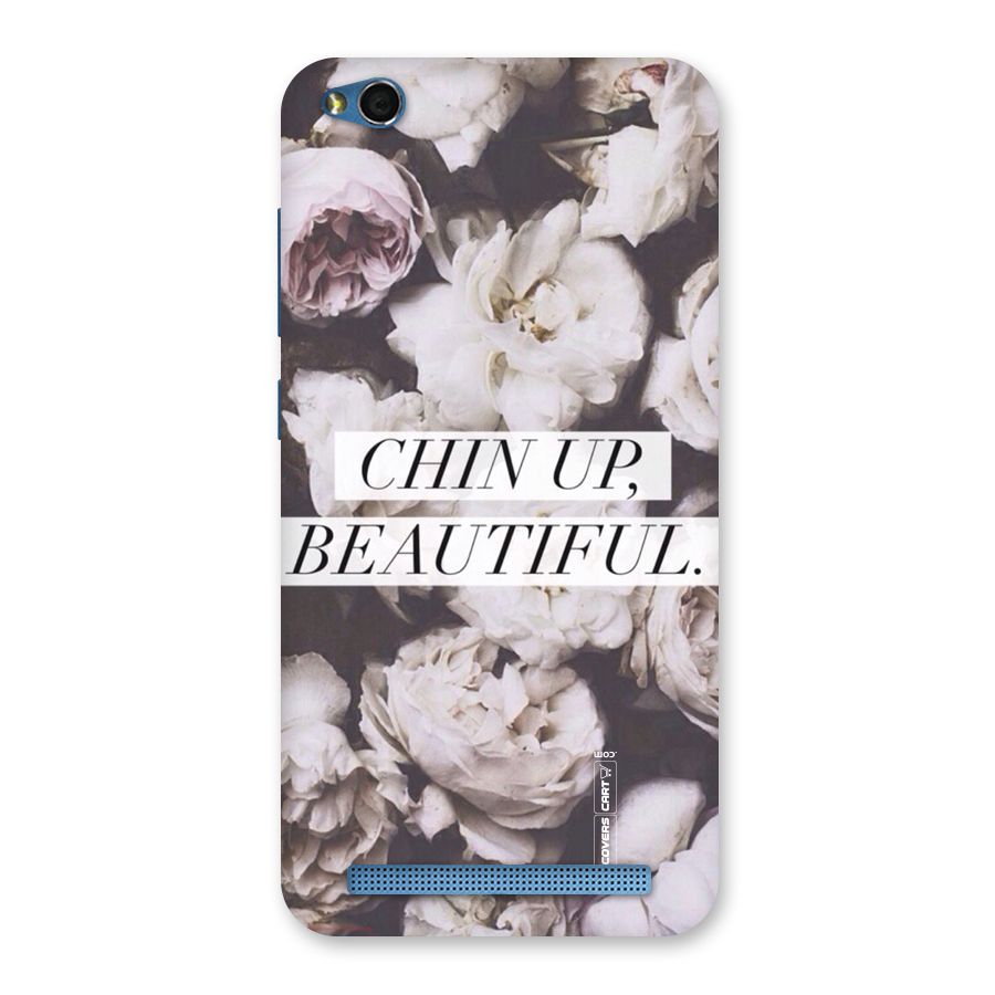 Chin Up Beautiful Back Case for Redmi 5A
