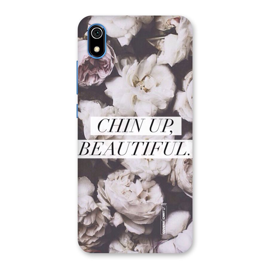 Chin Up Beautiful Back Case for Redmi 7A