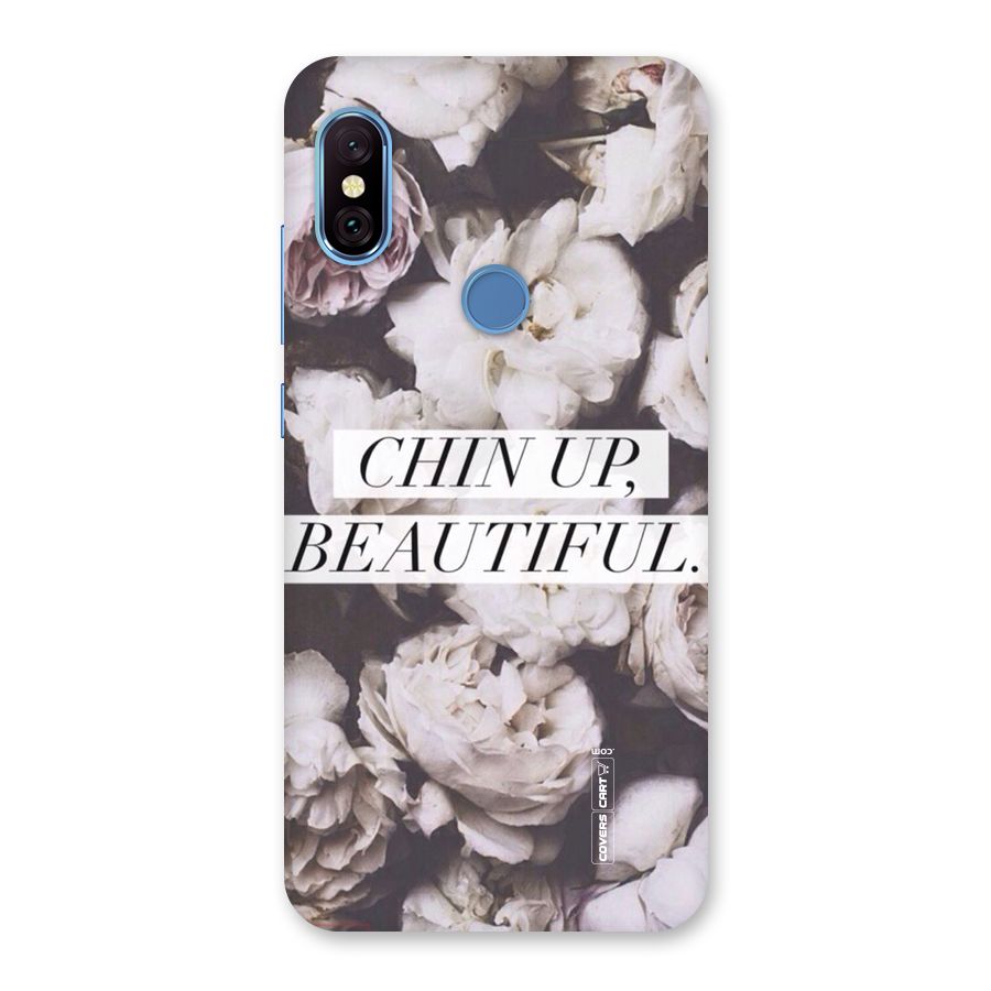 Chin Up Beautiful Back Case for Redmi Note 6 Pro
