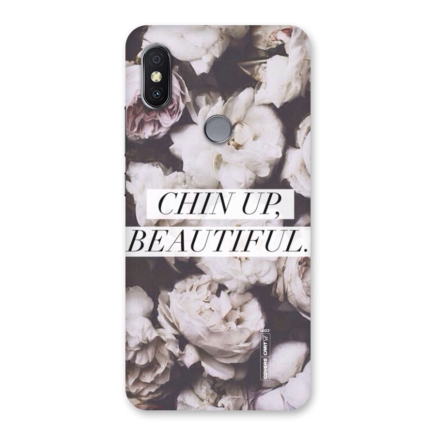 Chin Up Beautiful Back Case for Redmi Y2