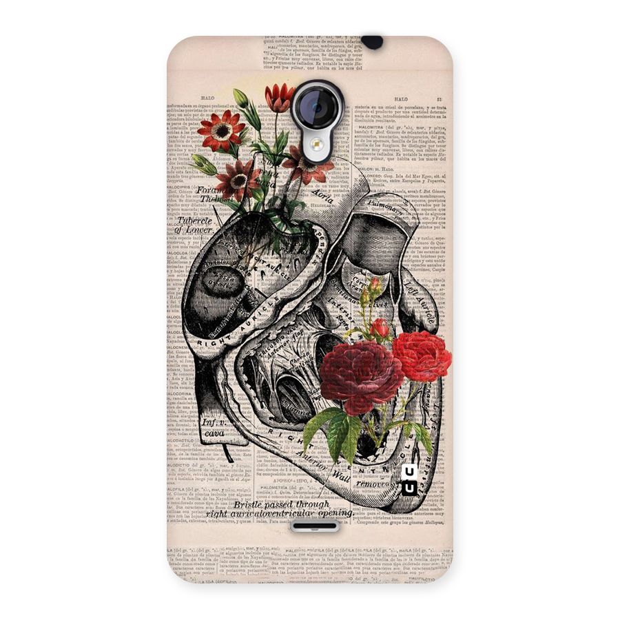 Heart Newspaper Back Case for Micromax Unite 2 A106