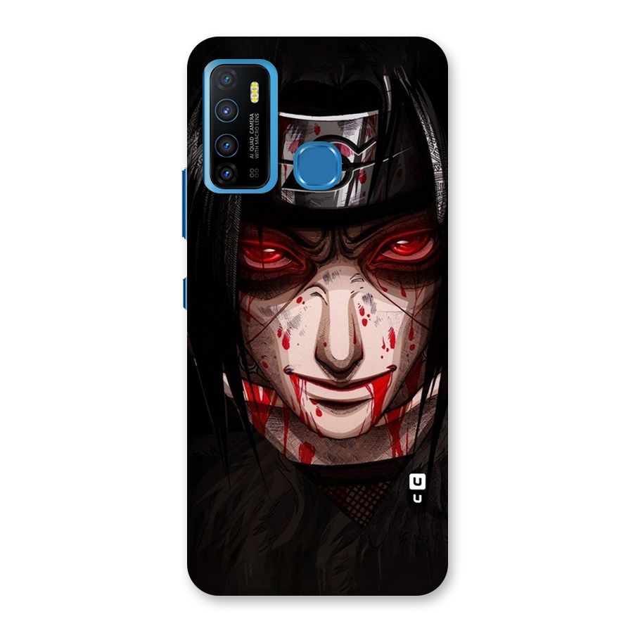 Itachi Uchiha Red Eyes Back Case for Infinix Hot 9