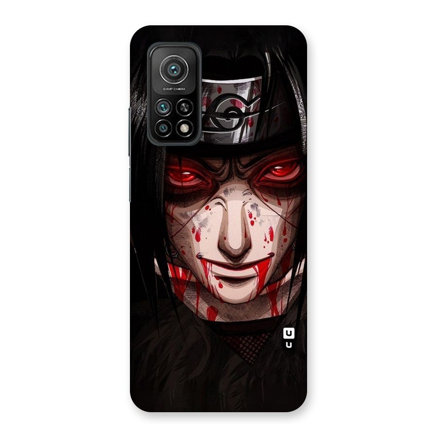 Itachi Uchiha Red Eyes Back Case for Mi 10T 5G