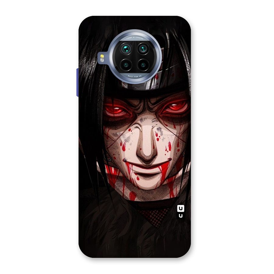 Itachi Uchiha Red Eyes Back Case for Mi 10i