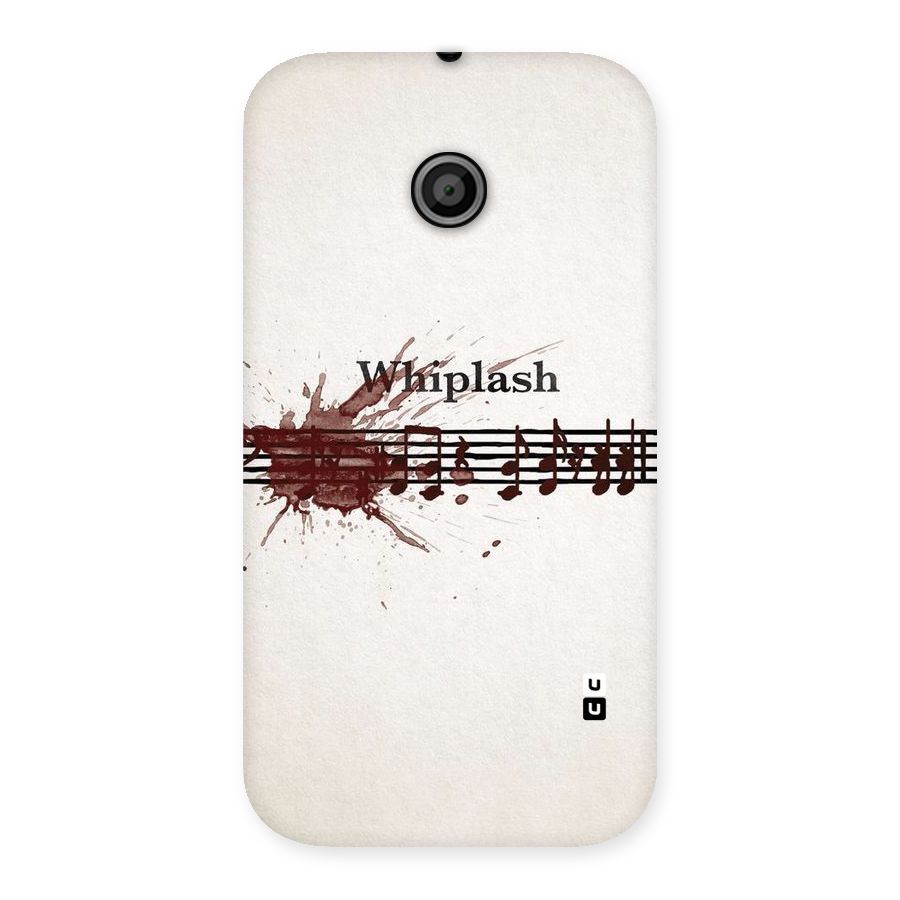 Music Notes Splash Back Case for Moto E