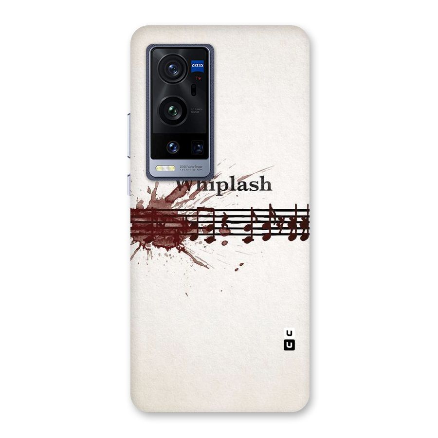 Music Notes Splash Back Case for Vivo X60 Pro Plus