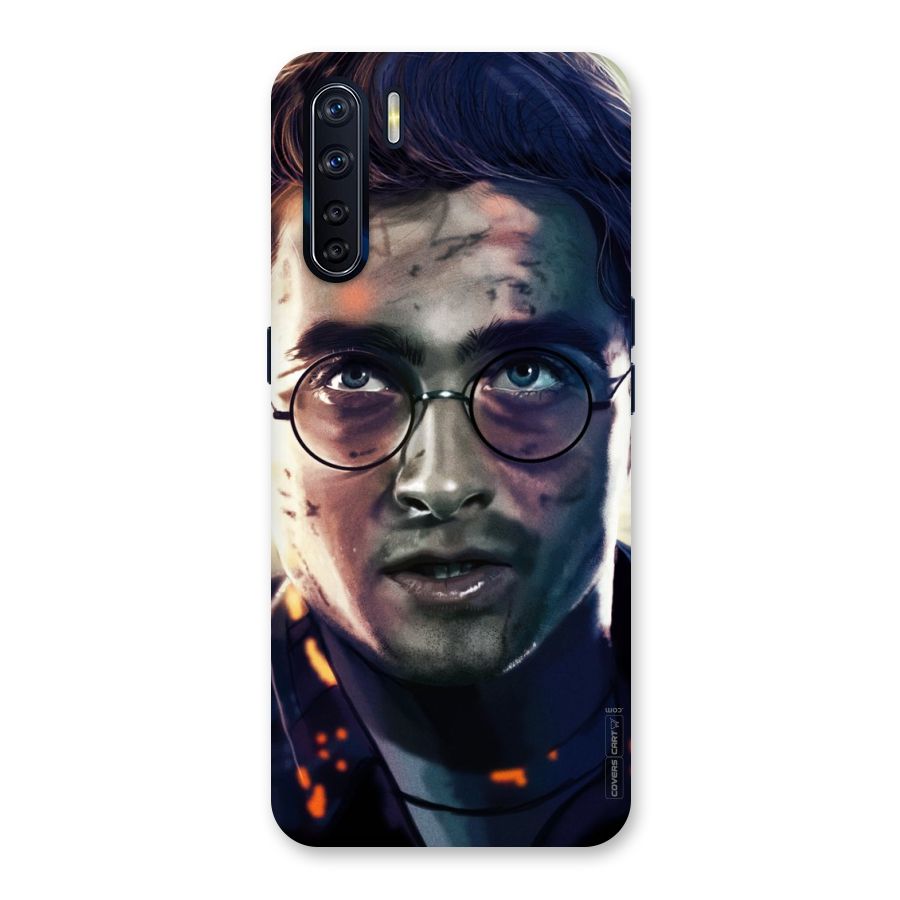 The Boy Who Lived Back Case for Oppo F15