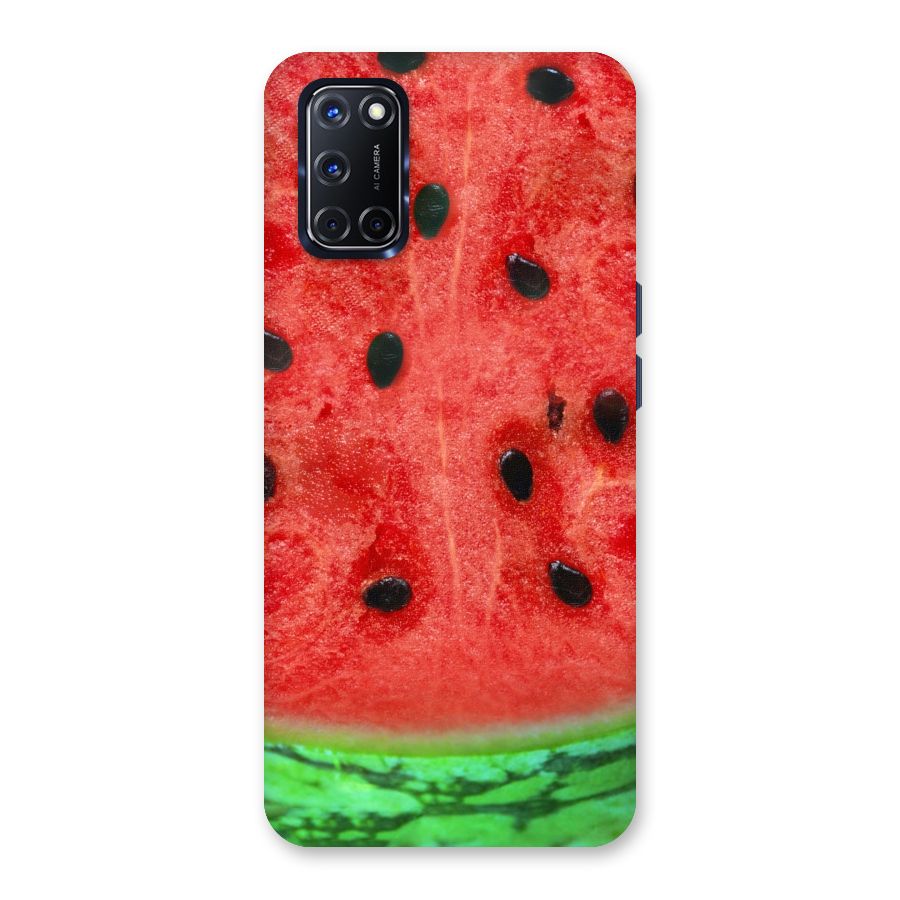 Watermelon Design Back Case for Oppo A52