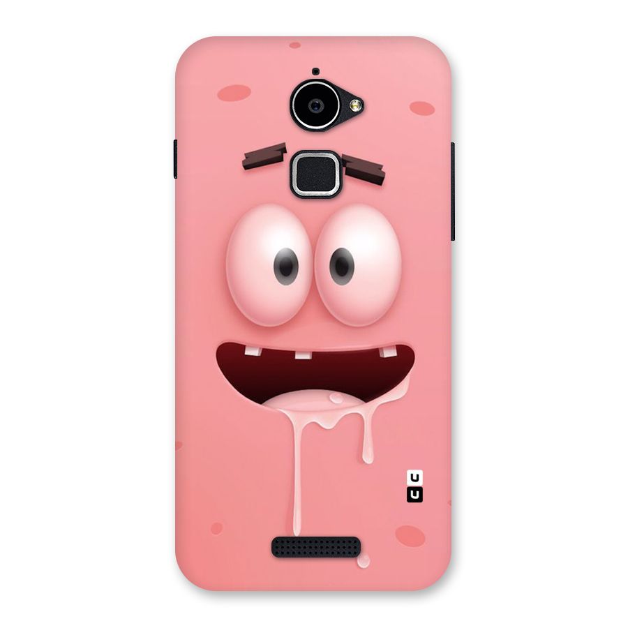 Watery Mouth Back Case for Coolpad Note 3 Lite