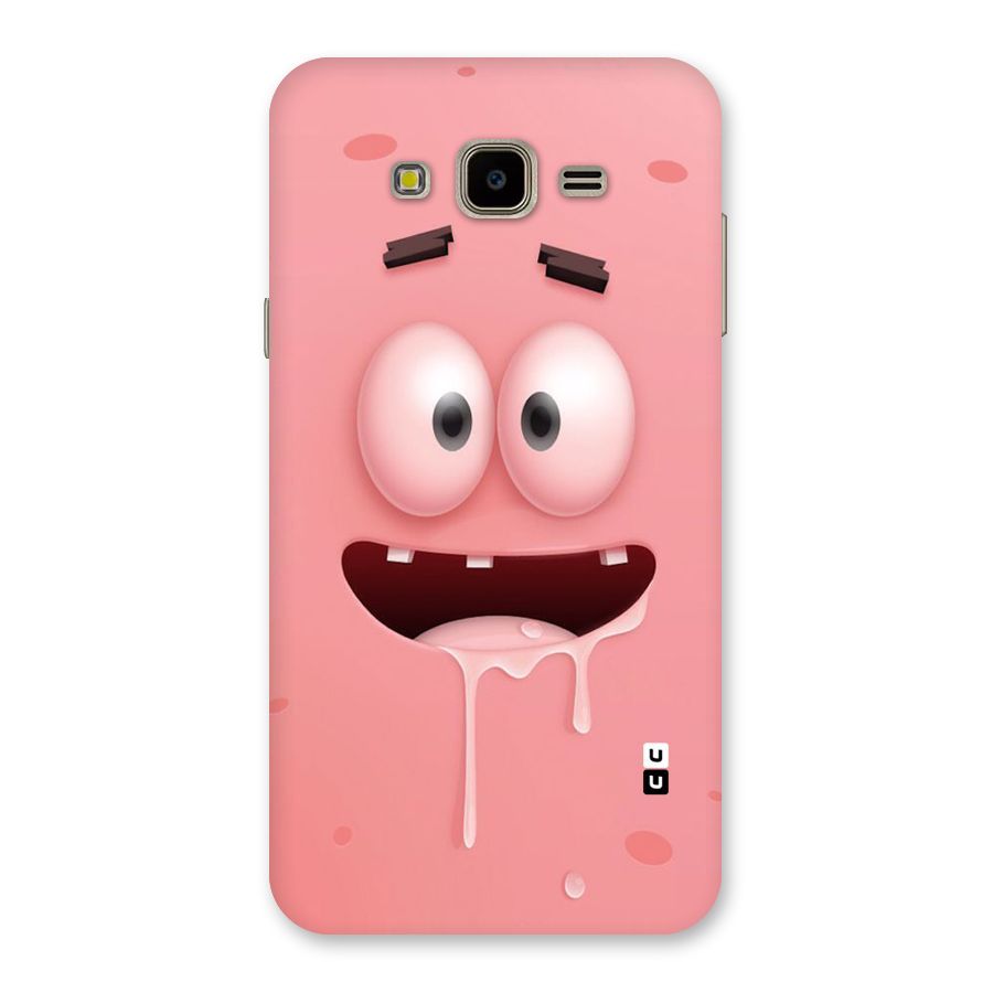 Watery Mouth Back Case for Galaxy J7 Nxt