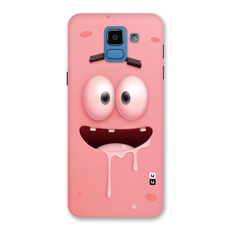 Watery Mouth Back Case for Galaxy On6