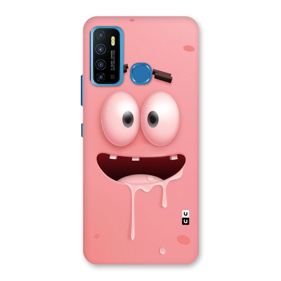 Watery Mouth Back Case for Infinix Hot 9
