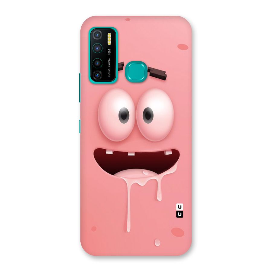 Watery Mouth Back Case for Infinix Hot 9 Pro