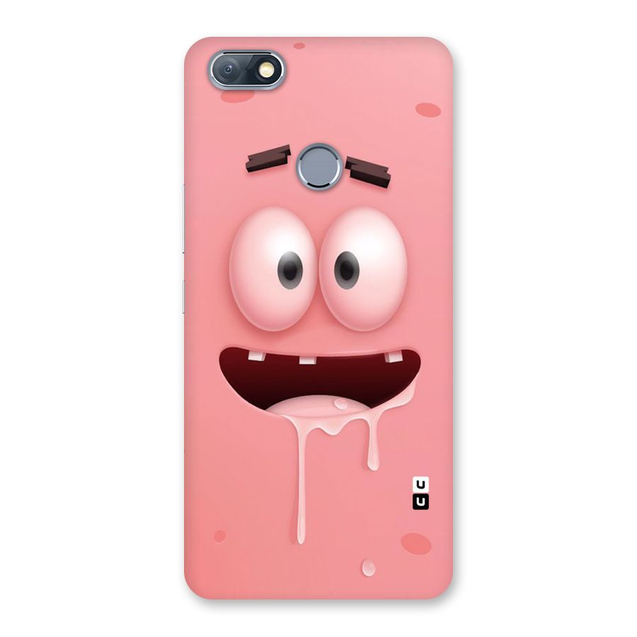 Watery Mouth Back Case for Infinix Note 5