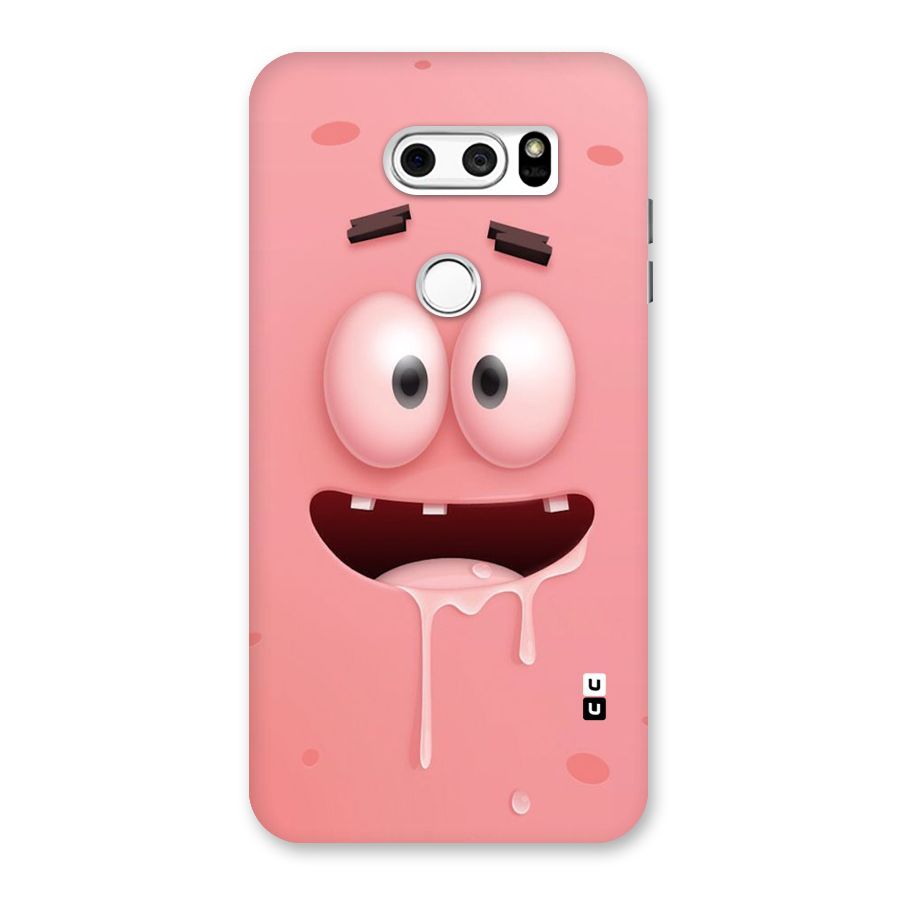 Watery Mouth Back Case for LG V30