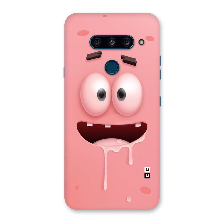 Watery Mouth Back Case for LG  V40 ThinQ