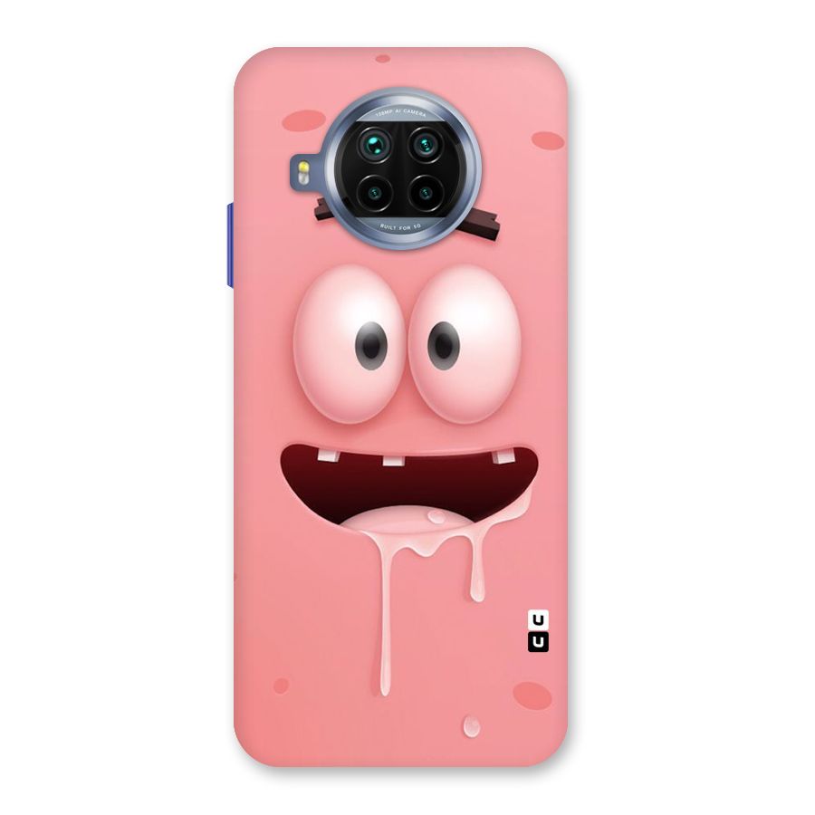 Watery Mouth Back Case for Mi 10i
