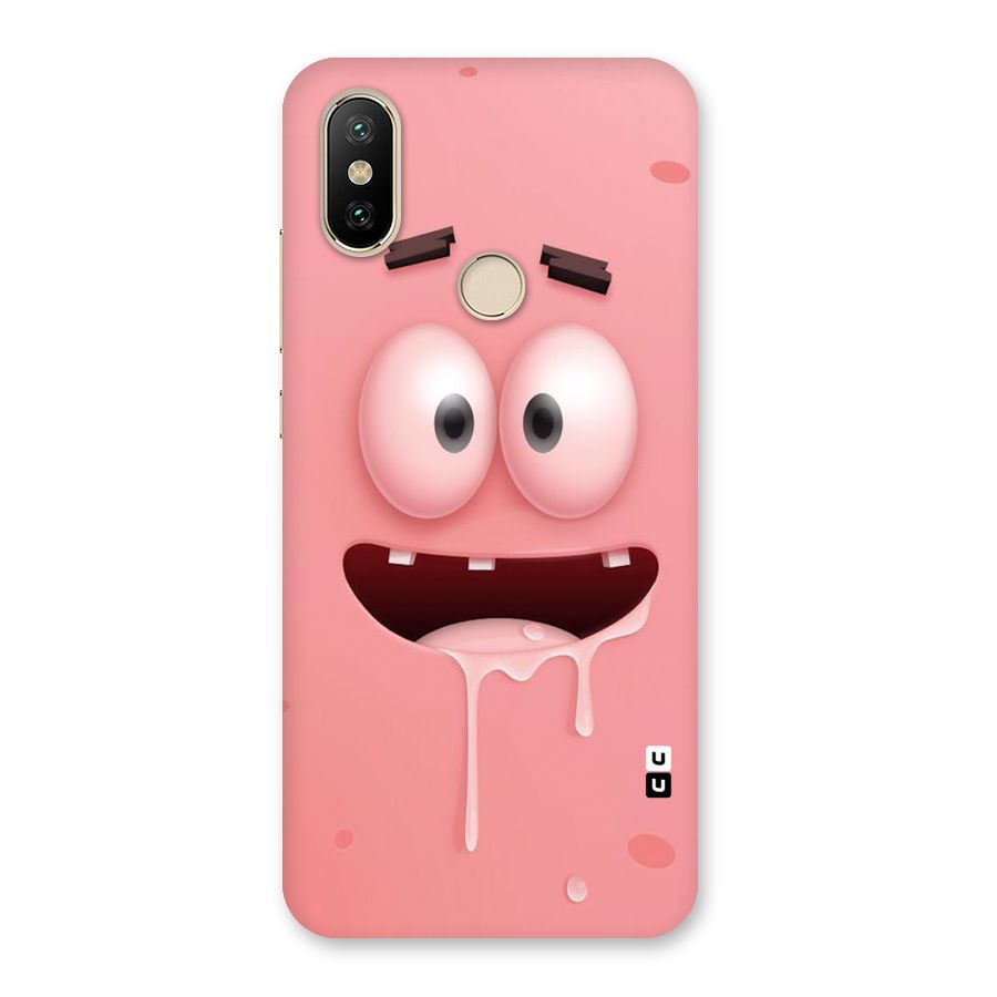 Watery Mouth Back Case for Mi A2