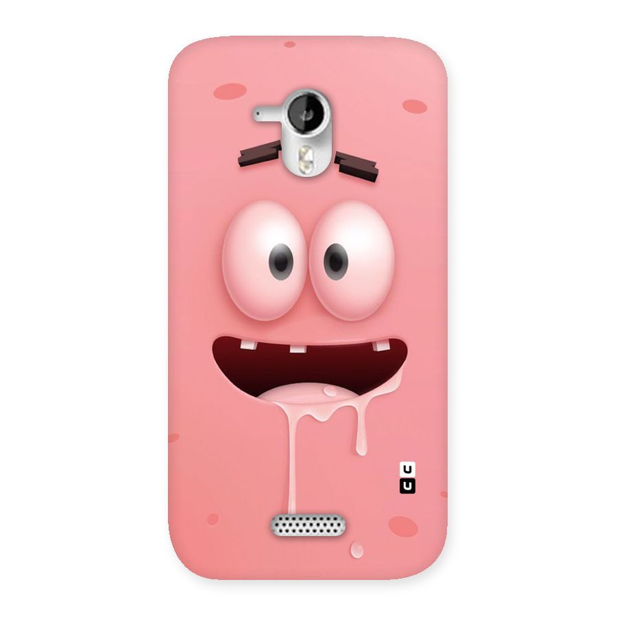 Watery Mouth Back Case for Micromax Canvas HD A116
