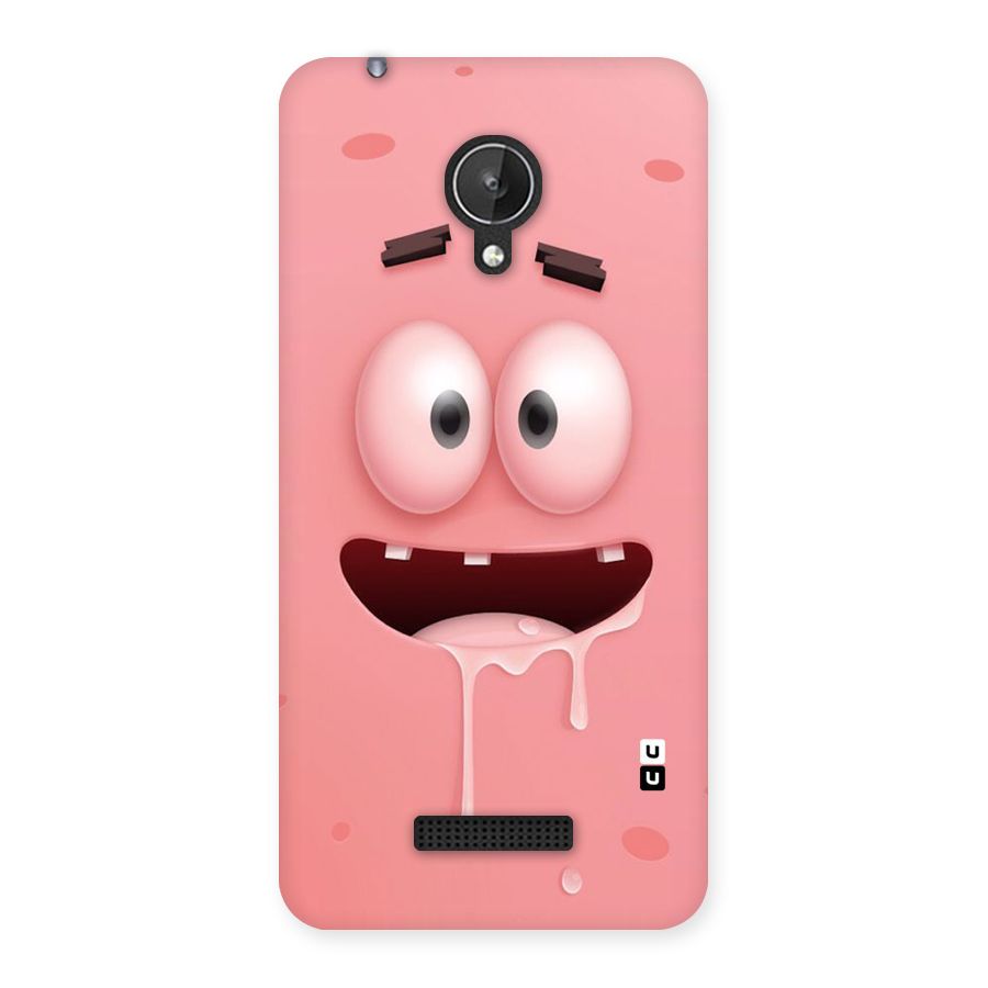 Watery Mouth Back Case for Micromax Canvas Spark Q380