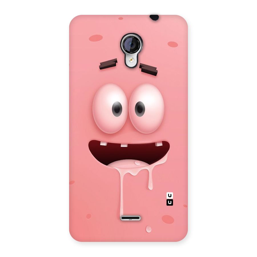 Watery Mouth Back Case for Micromax Unite 2 A106
