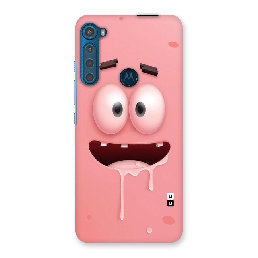 Watery Mouth Back Case for Motorola One Fusion Plus
