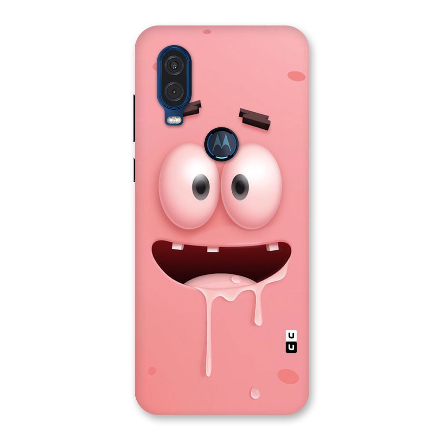 Watery Mouth Back Case for Motorola One Vision