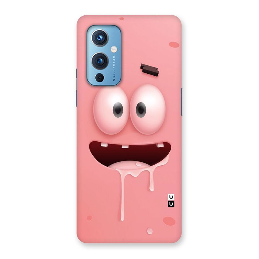 Watery Mouth Back Case for OnePlus 9