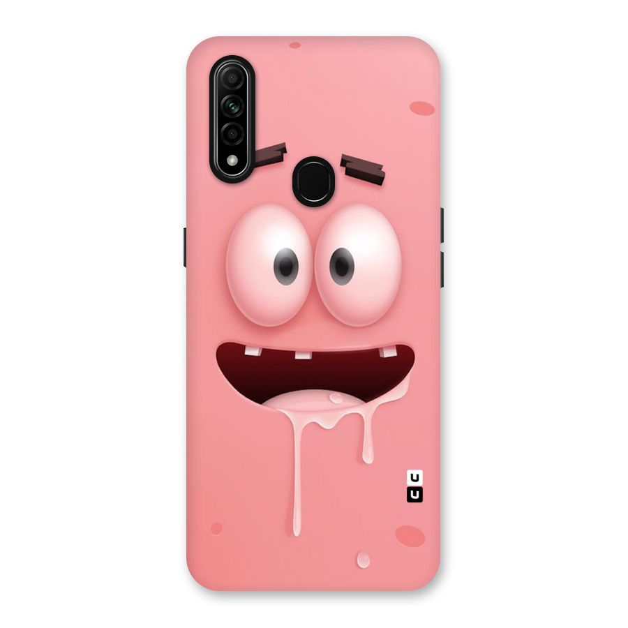Watery Mouth Back Case for Oppo A31