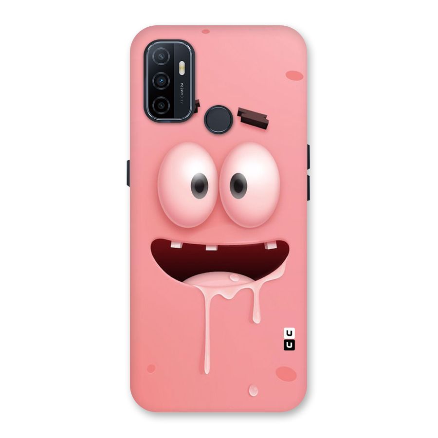 Watery Mouth Back Case for Oppo A32