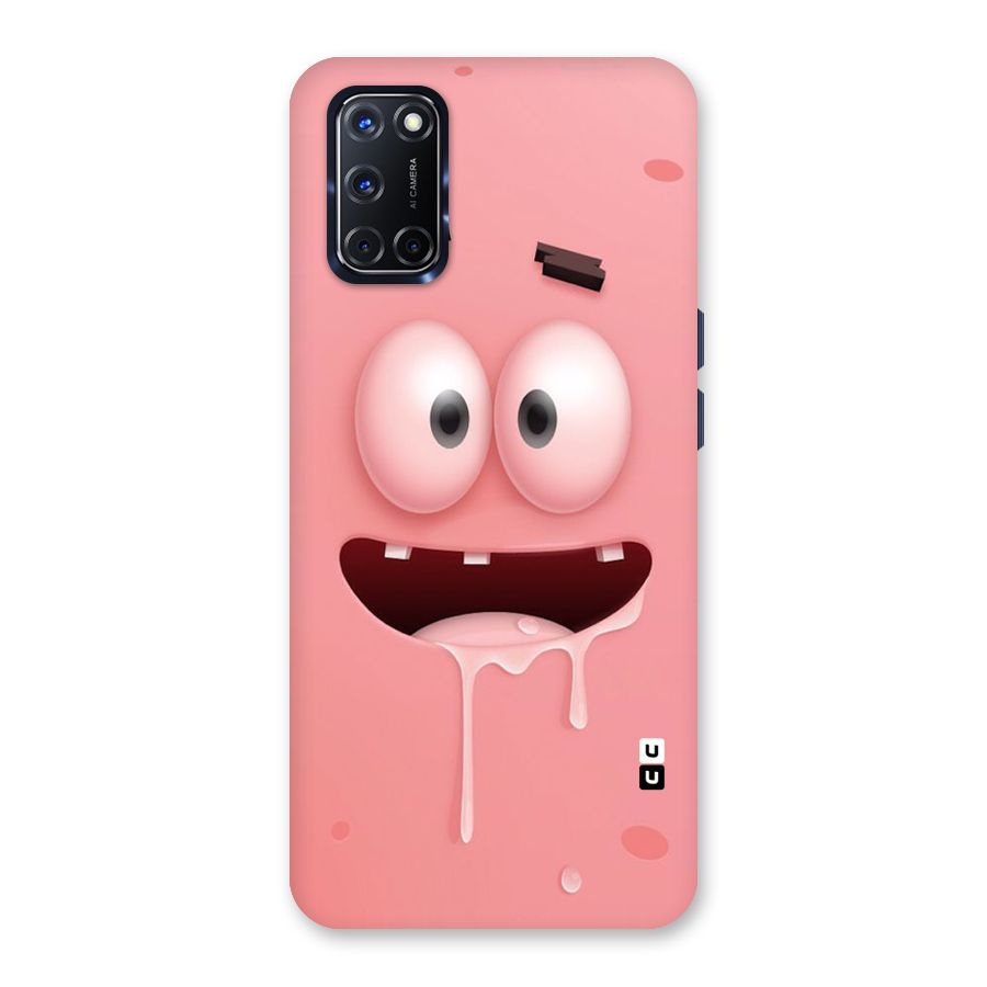 Watery Mouth Back Case for Oppo A52