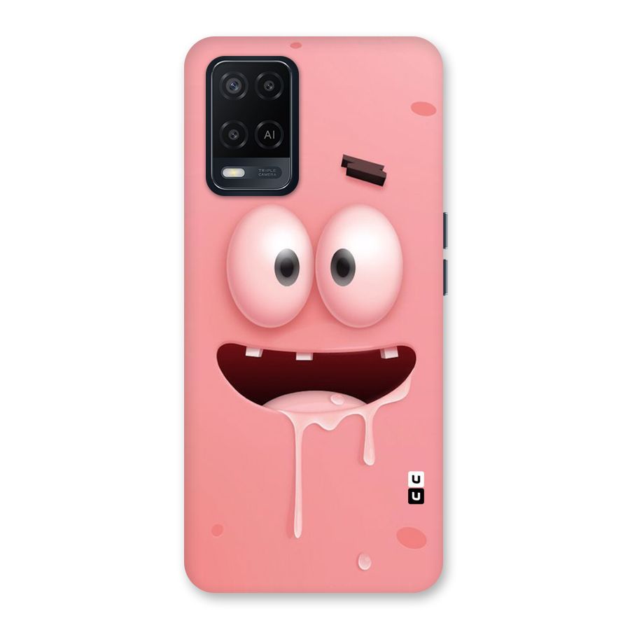 Watery Mouth Back Case for Oppo A54