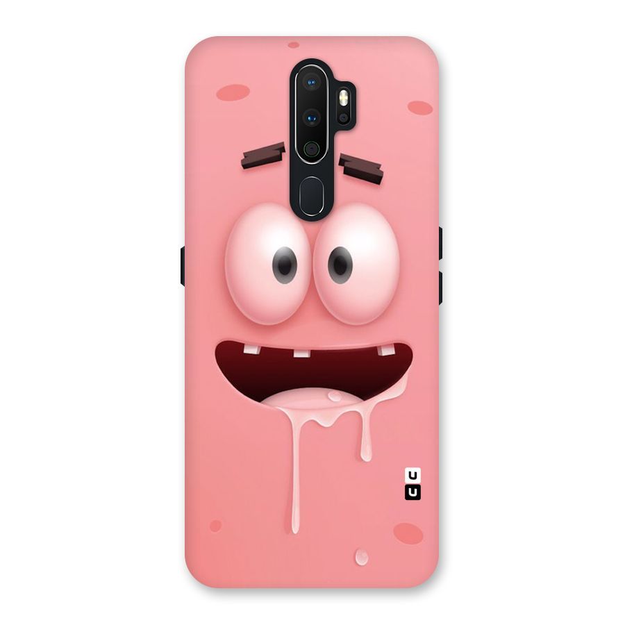 Watery Mouth Back Case for Oppo A5 (2020)