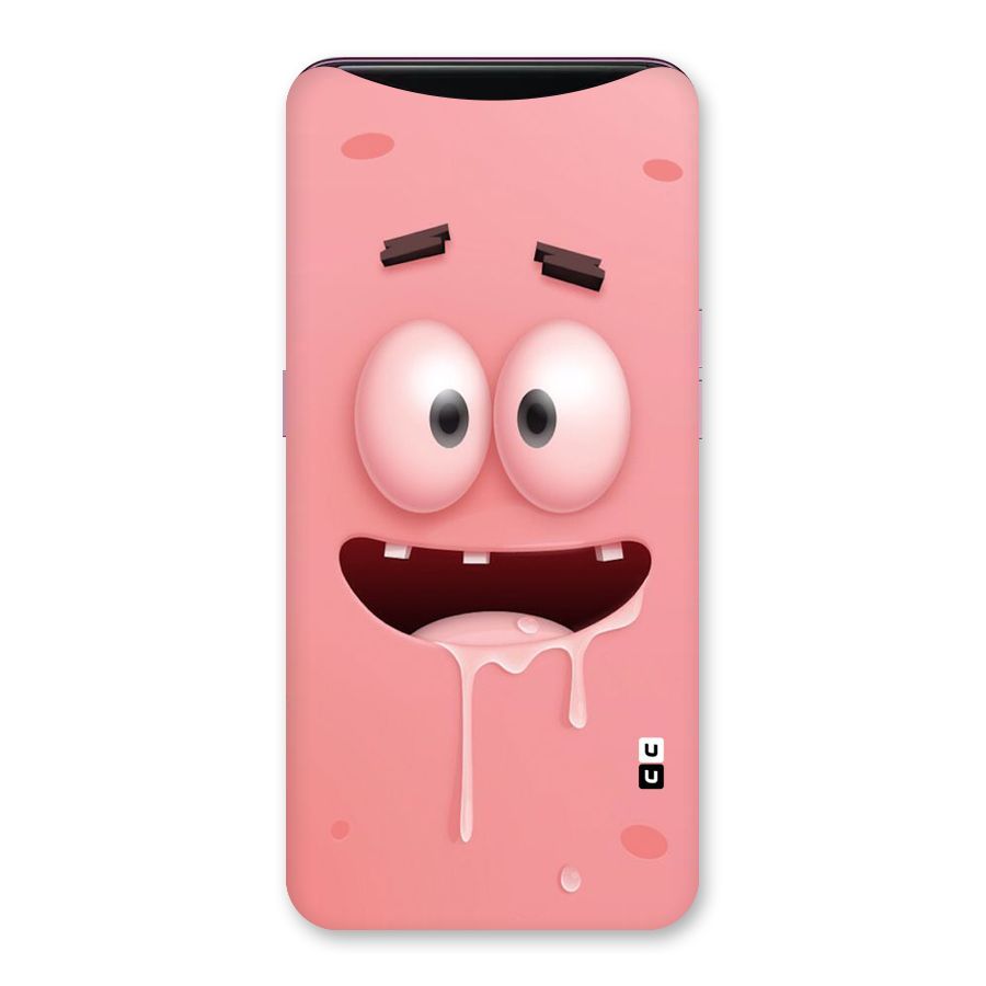 Watery Mouth Back Case for Oppo Find X