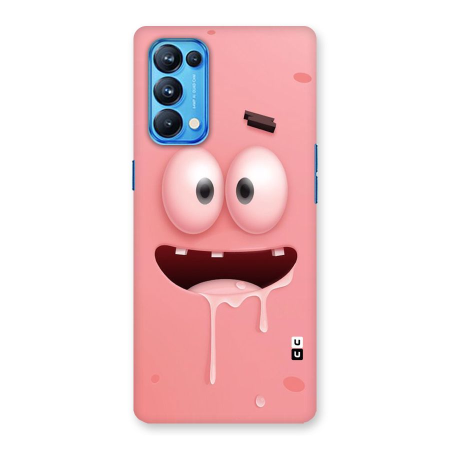 Watery Mouth Back Case for Oppo Reno5 Pro 5G