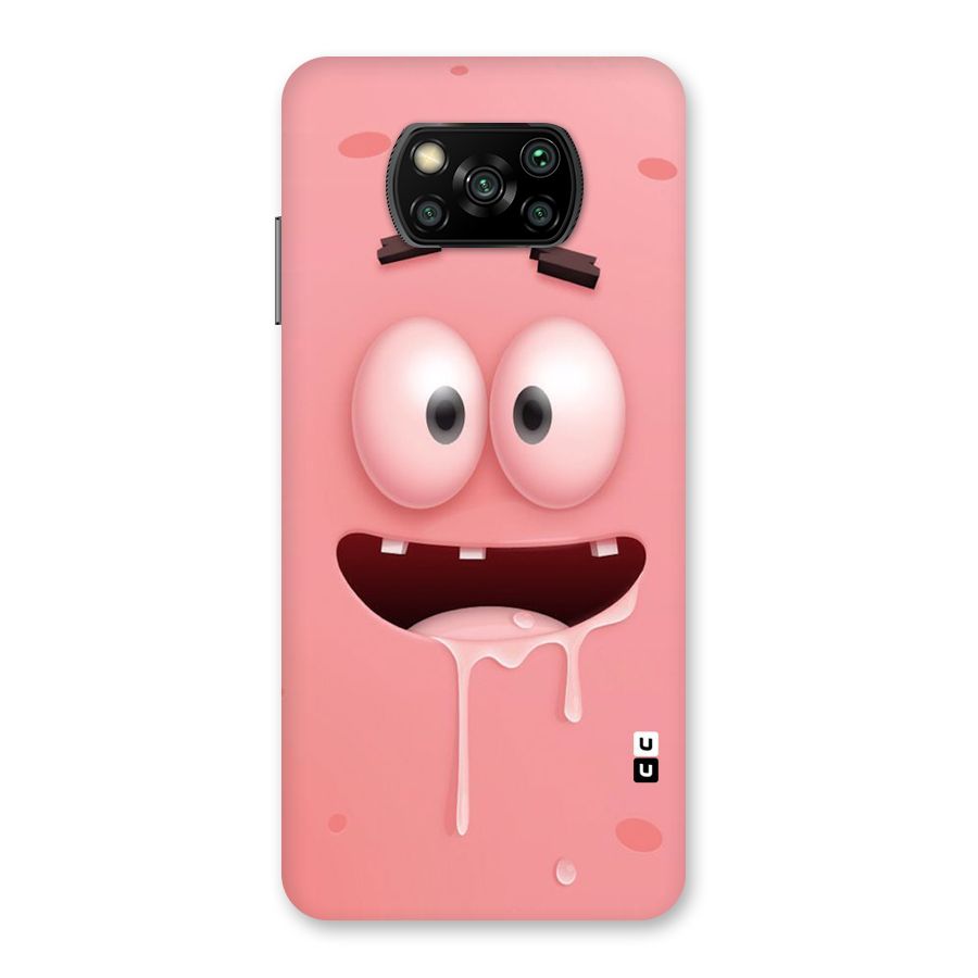 Watery Mouth Back Case for Poco X3